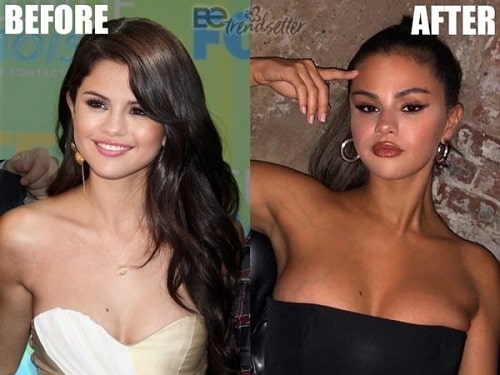 A picture of Selena Gomez before (left) and after (right).